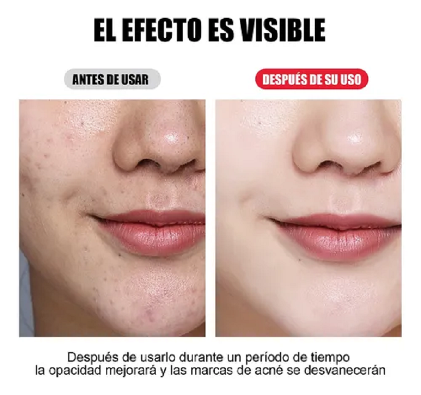 MASCARA LED FACIAL